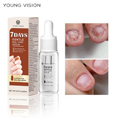 YOUNG VISION Nail Repair Essence, Grey Nail Hand and Foot Nail Repair Liquid, Nail Care Solution