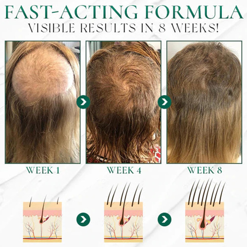 Jaysuing Centella Asiatica Scrub Hair Cleansing, Anti-Dandruff, Anti-Itching, Scalp Anti-Falling and Growth Scrub