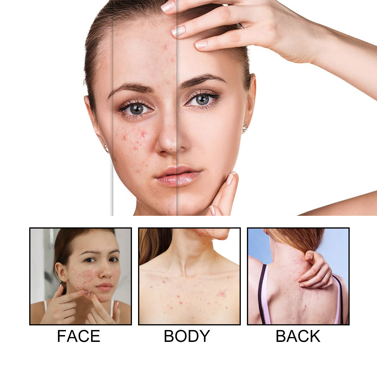 West&Month Colored Patch for Fading Marks and Color Alien Portable Invisible Acne Mask_voghion.com