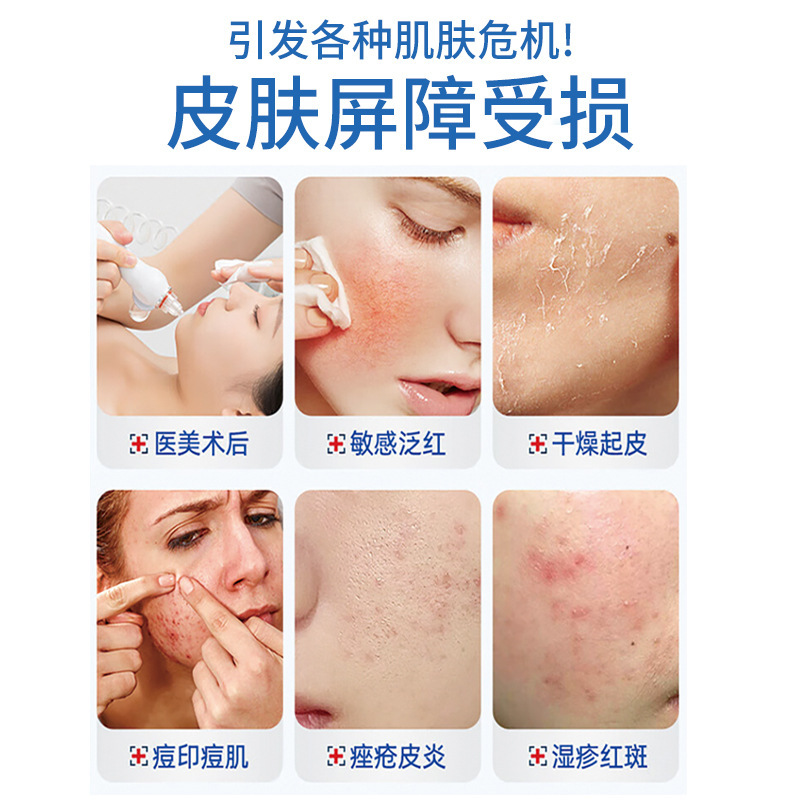 二类械字号医用皮肤修复敷贴厂家面部皮肤痤疮皮炎湿疹护理面膜|undefined