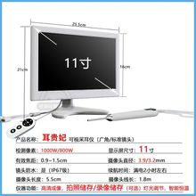 可视耳镜 高清10寸带屏耳鼻喉内窥镜耳朵鼻腔口腔检查原厂直销