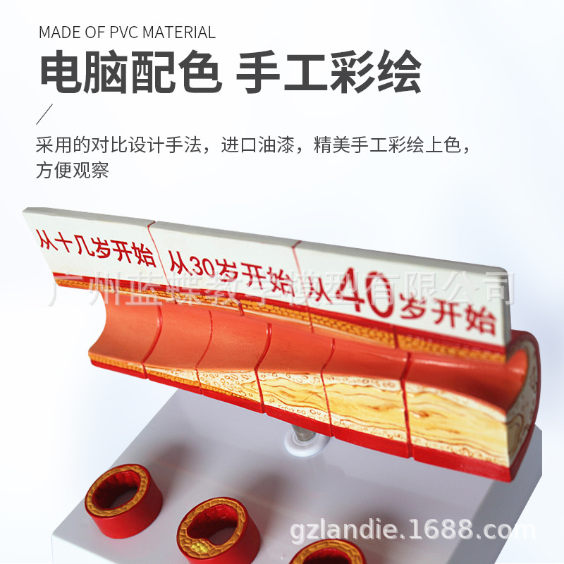 ����Ѫ�ܽ���ģ�� Ѫ��ģ�� ����/Ӳ��չʾ ���׶������Ѫ��չʾ