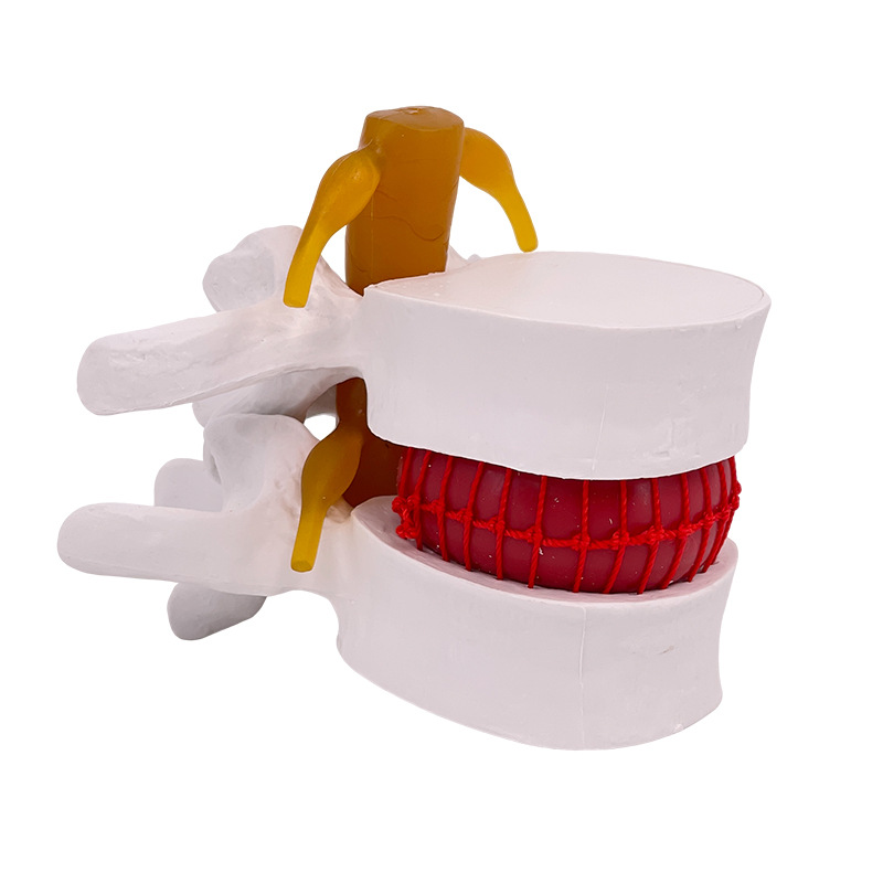 ��׵�Ŵ���׵������ѹ��ʾģ�����弹����׵�ǲ�����ʾ�ؽ�ҽѧ��