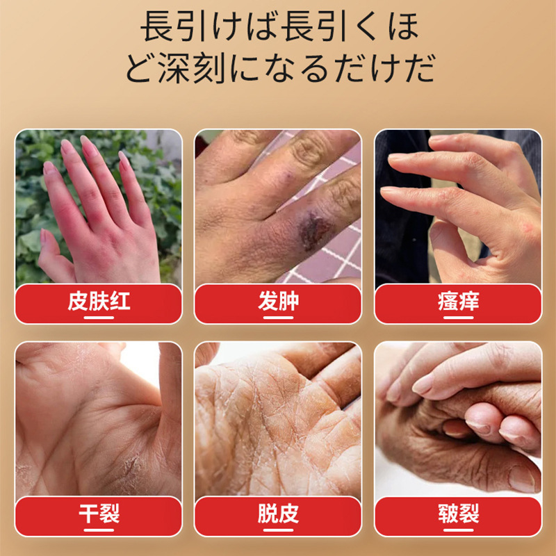 泰国红花干裂修复膏舒缓皮肤冬季冻伤干裂干痒瘙痒不适外用护理膏|undefined