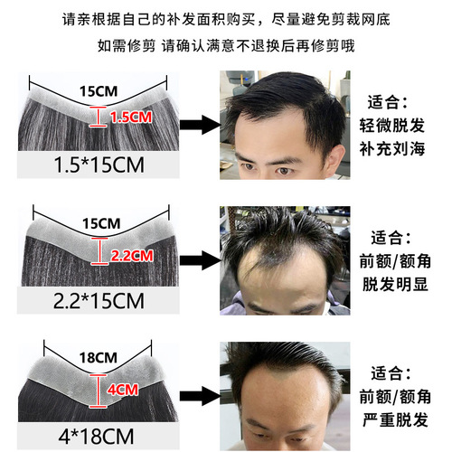Fully hand-woven biological scalp wig men's hairline wig piece real hair wig high forehead forehead replacement piece