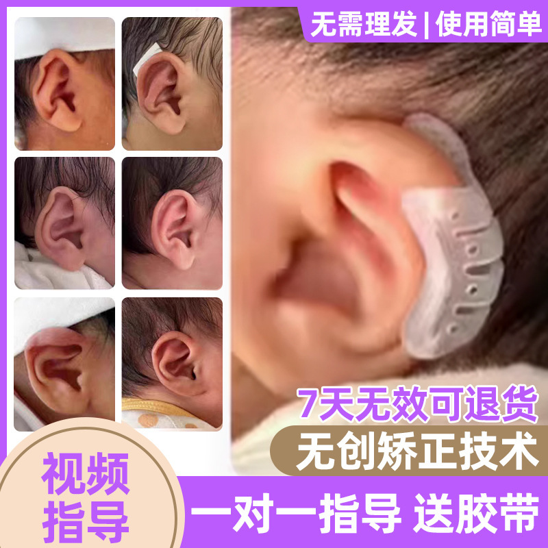 婴儿耳廓辅助器宝宝耳朵定型贴招风耳塑形新生儿硅胶带耳畸形耳撑|undefined