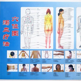 穴位图泻血图A3大小