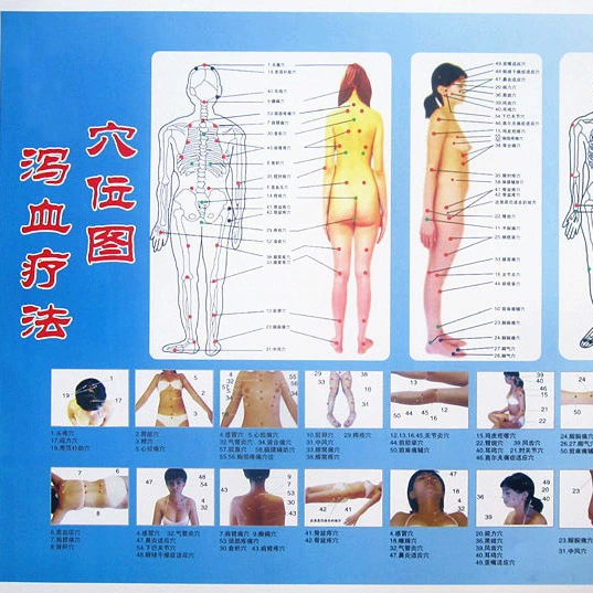 Acupoint диаграмма диареи диаграмма крови A3 размер