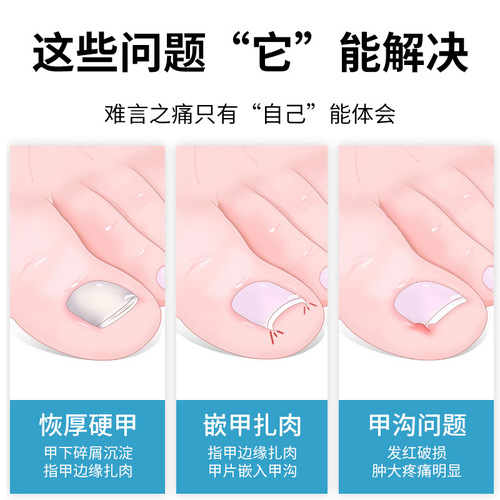 Nail groove special nail scissors set toenail scissors pedicure knife household oblique ingrown toenail hawkbill pliers pedicure set