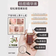 ����AҺ�ӡ�����]�ڷ۴����o�����տsë��ֲ��lЧ����Ժoe