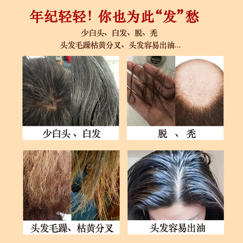 Ginseng and Huangjing Mulberry Tea Black Bean, Black Sesame and Huangjing Tea Raspberry Ginseng and Black Plum Health Tea Small Can