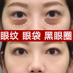超音波ナイフのアイクリームはしわに強いです。