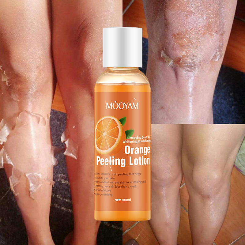 Orange Peel Lotion, Peeling Oil, Body Lotion, Gentle Exfoliating Gel, Orange Peeling Lotion
