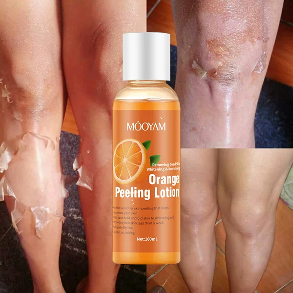 Orange Peel Lotion, Peeling Oil, Body Lotion, Gentle Exfoliating Gel, Orange Peeling Lotion