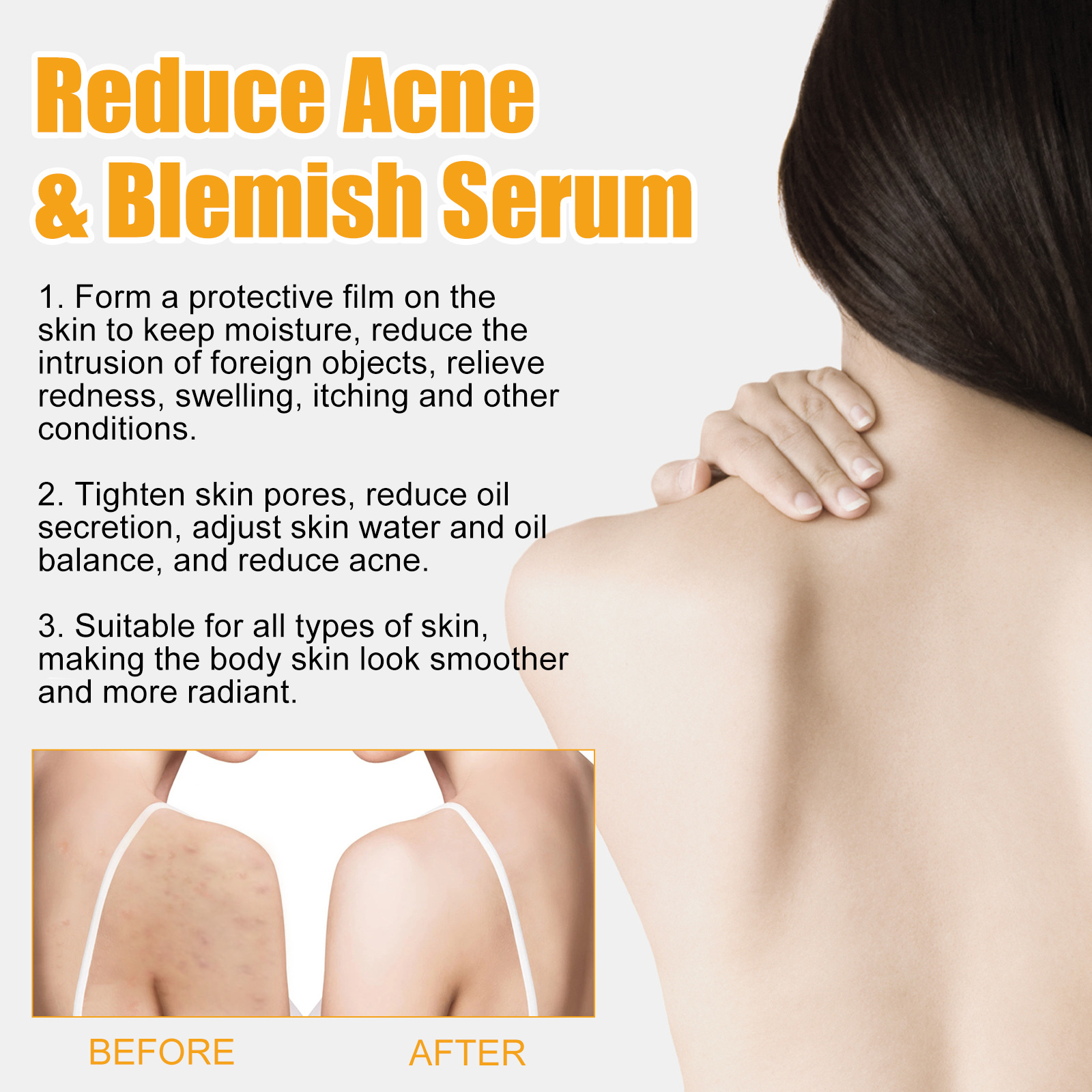 Jayusing Anti Cream Lighten and Acne Marks Esencja do nawilżania i naprawy skóry na ustach_voghion.com