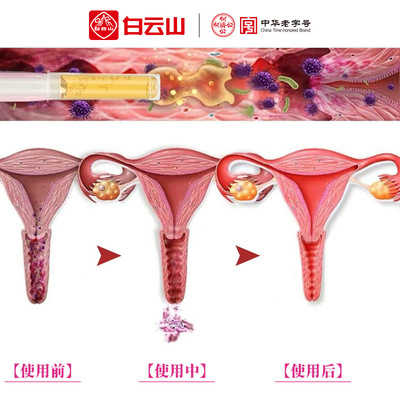 白雲山婦科凝膠私密處緊致收緊産後修護宮頸二度爛糜重度用藥正品
