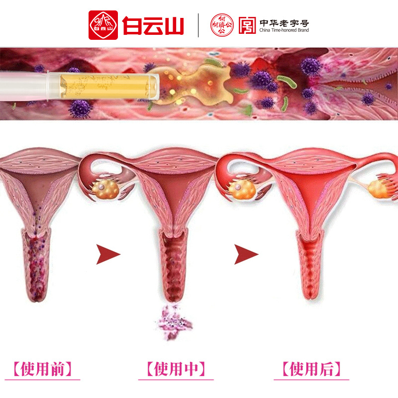 白雲山婦科凝膠私密處緊致收緊産後修護宮頸二度爛糜重度用藥正品