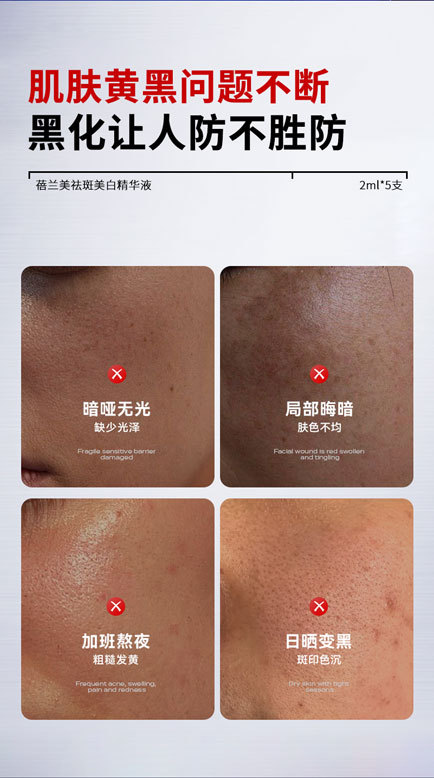 In Stock 377 Spot Removal Whitening Disposable Essence Serum with Niacinamide Melanin Inhibitor Acne Root Treatment Factory Wholesale