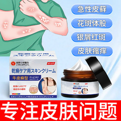 牛皮癬クリーム、皮膚のかゆみ、赤み、腫れを緩和し、修復するクリーム、手足の白い皮膚炎、癜風、牛皮癬専用クリーム、緩和