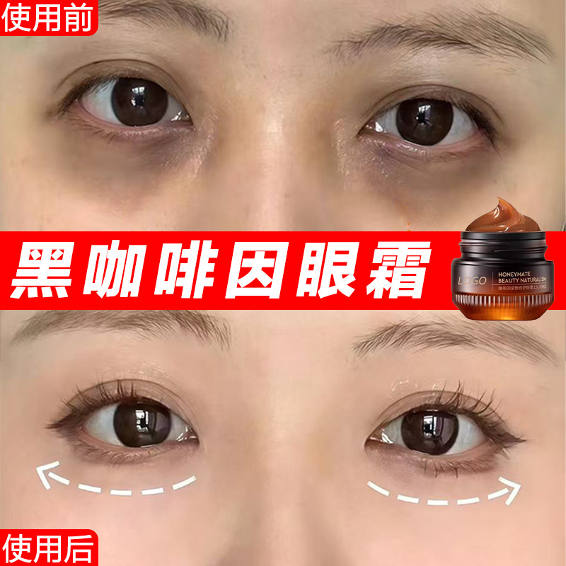 Black Caffeine Eye Cream Reduces Dark Circles, Eye Wrinkles, and Bags under the Eyes, Removes Fine Lines and Fat Particles, and Is a Professional-Grade Firming Anti-Wrinkle Eye Cream Black Caffeine Eye Cream Reduces Dark Circles, Eye Wrinkles, and Bags under the Eyes, Removes Fine Lines and Fat Particles, and Is a Professional-Grade Firming Anti-Wrinkle Eye Cream