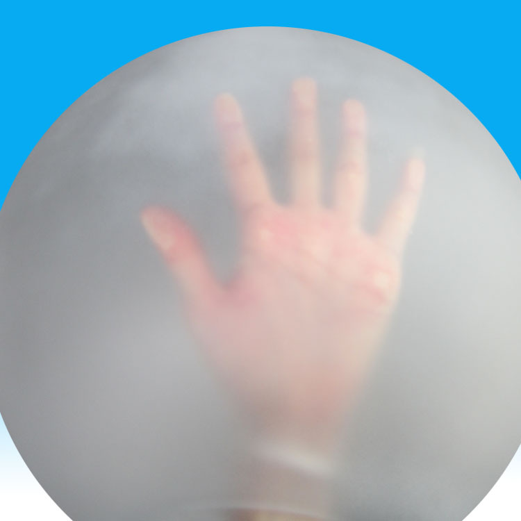 야외 칼럼 헤드 램프 볼 그늘 프로스트 반투명 줄무늬 모래 방수 벽 램프 그늘