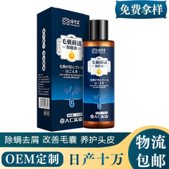 メーカーのダニの毛の炎の袋の寧のシャンプーの卸売りはくずを取り除いてかゆみを止めます。