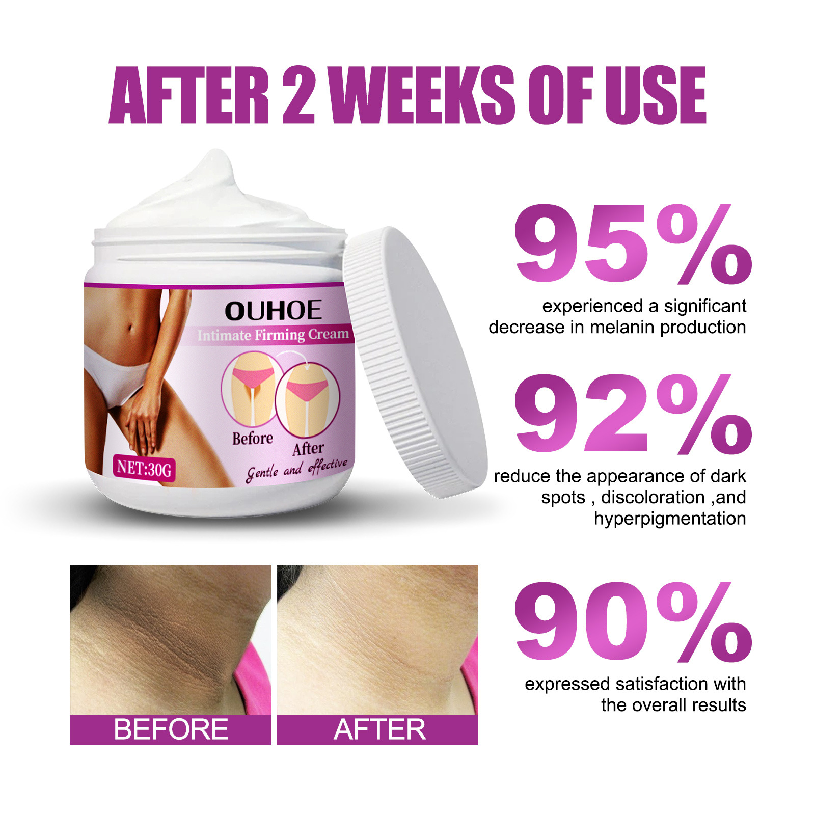 OUHOE krema za učvrstitev kože za pazduhe, komolce, ten kože, melanin za posvetlitev in beljenje kože,_voghion.com