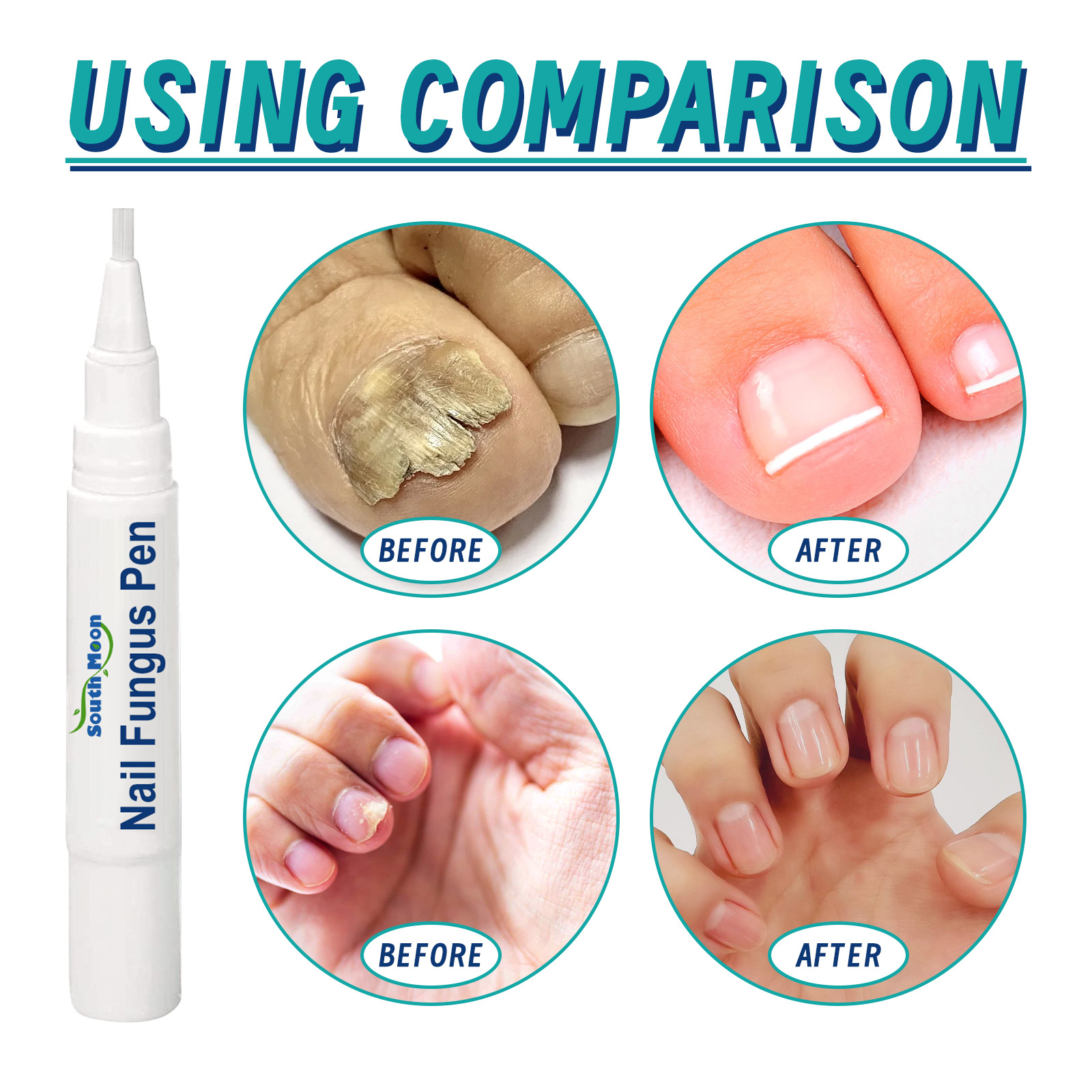 Stylo de réparation South Moon répare les mains et les pieds gris ongles doux brillants épaississement de la Surface des ongles soin hydratant_voghion.com