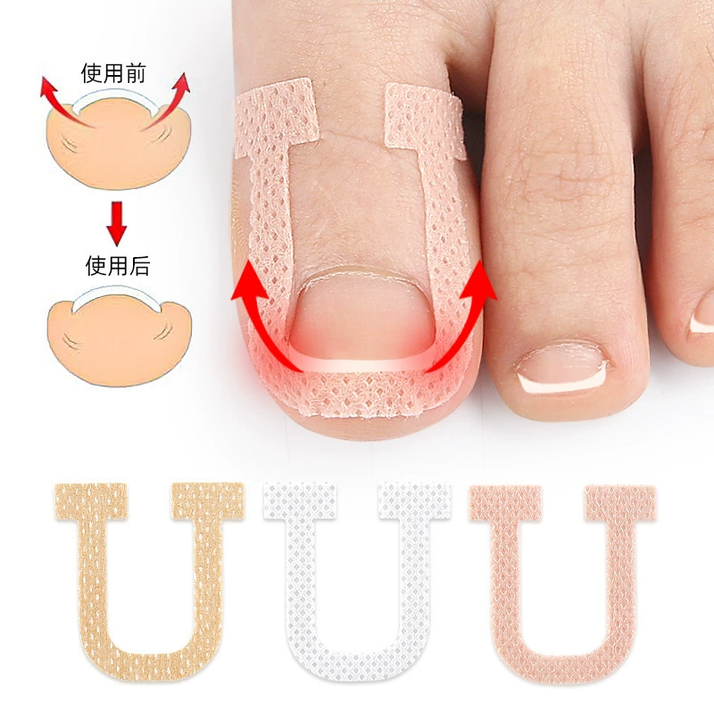 U-образная нога в пазе для ногтей эластичная растяжка без клея ногтей