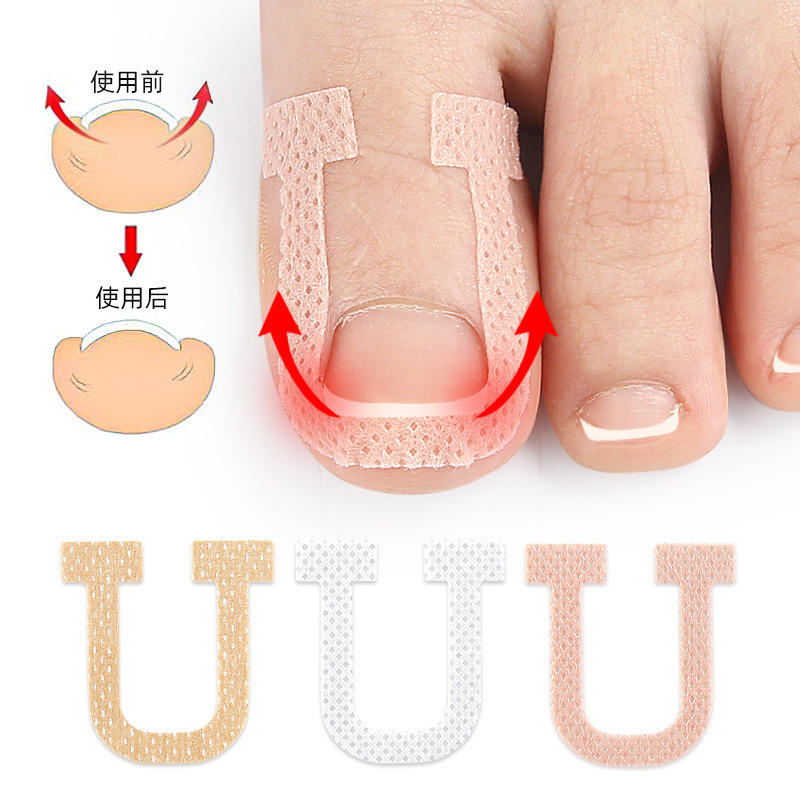 U-shaped nail sticker nail groove roll elastic stretch no glue inlay toe pad nail adjustment orthopedic patch U-shaped nail sticker nail groove roll elastic stretch no glue inlay toe pad nail adjustment orthopedic patch
