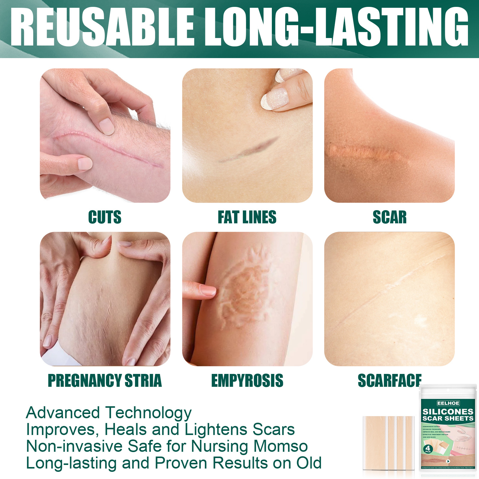 EELHOE silikono gelio gėlinimo operacija nėštumas raukšlės nudegimas randas lopas lygi oda žaizdų taisymas_voghion.com