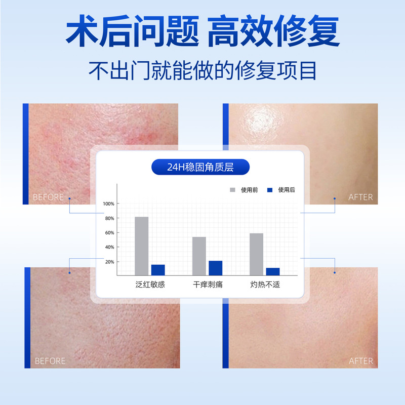 曼诺森医用重组Ⅲ型人源化胶原蛋白修护凝胶院线高端护肤祛痘膏|undefined