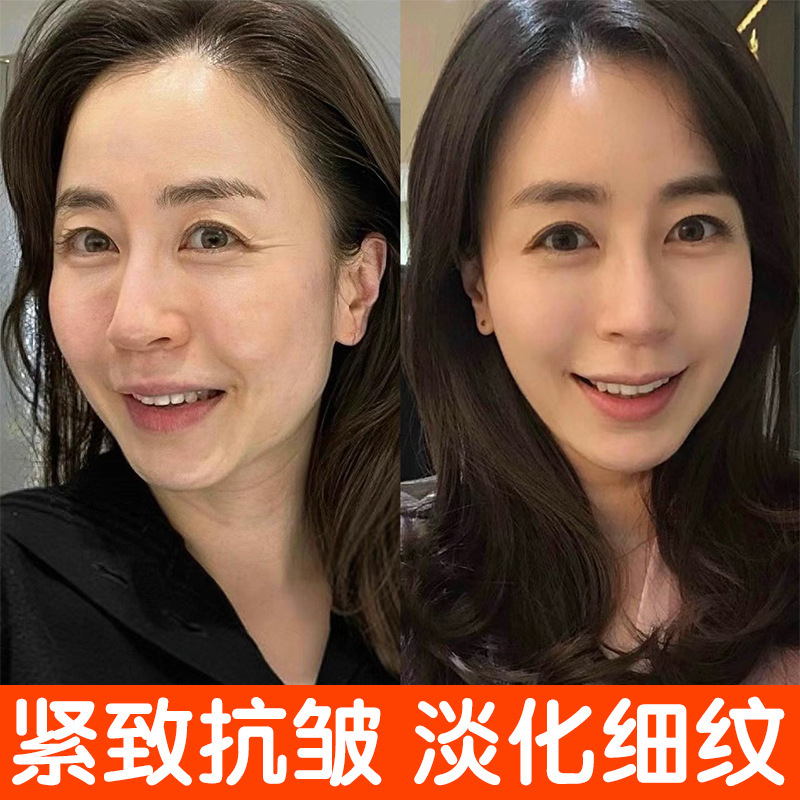 断紋液は引き締めてしわに抵抗します。|undefined