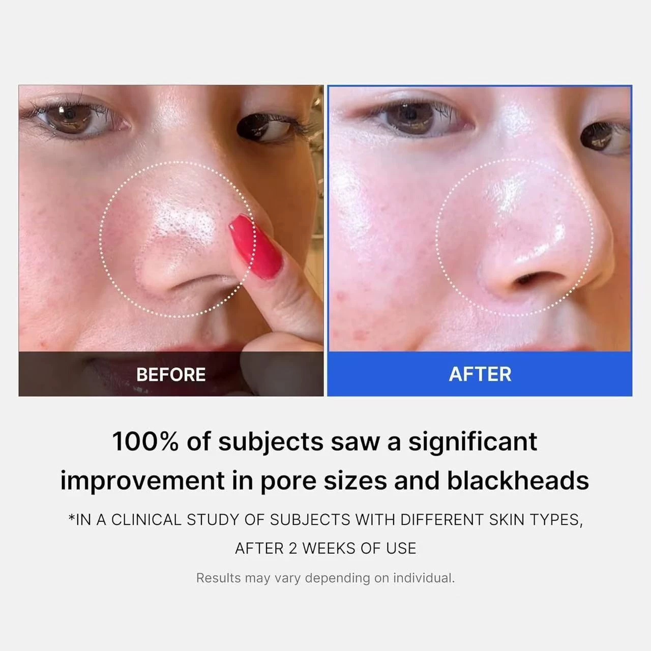 Amazon Hot Salesylic Acid Cleansing Tablets ZERO PORE PAD Improves Pore Blackhead Cleansing