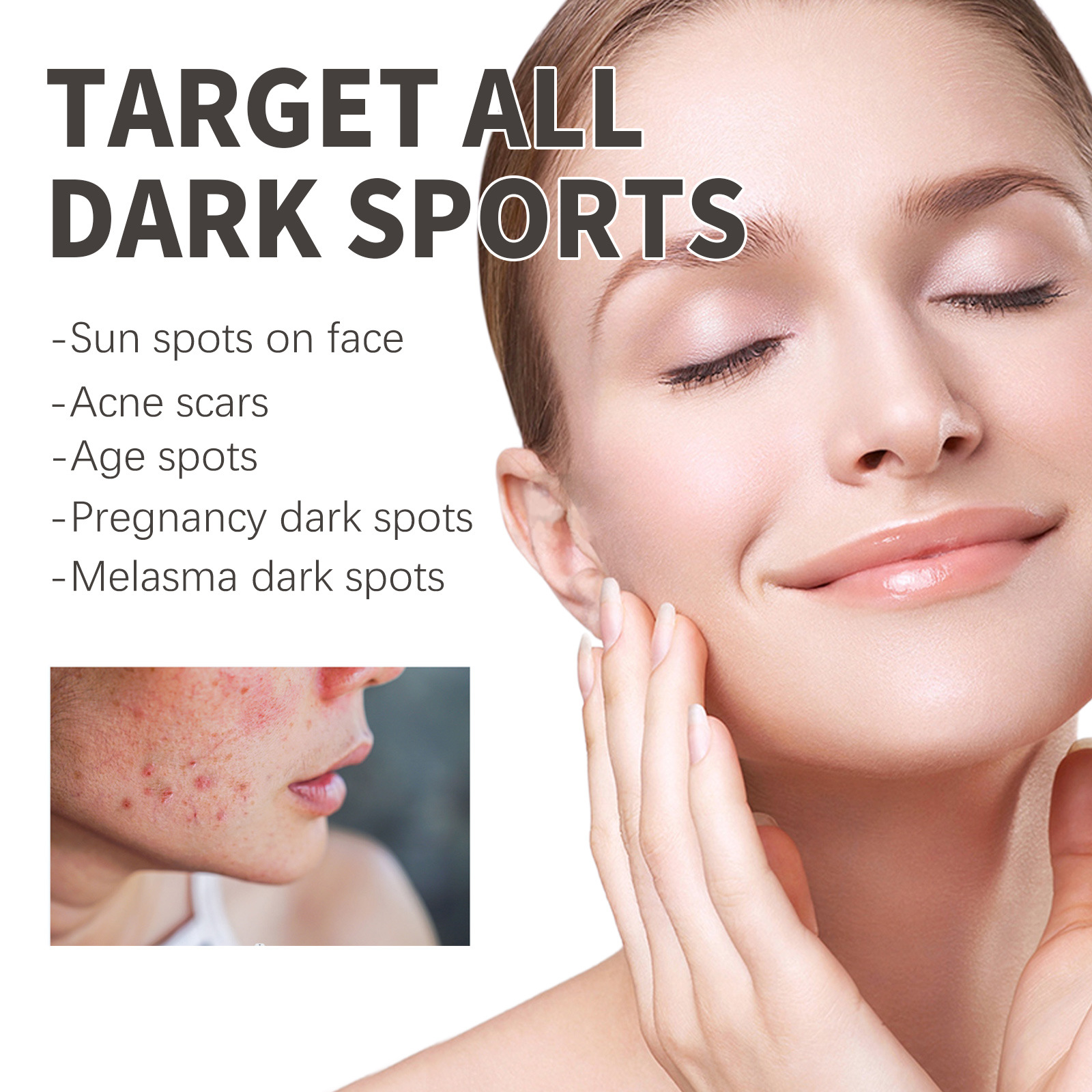 OUHOE Dark Spot&Acne för att bleka fläckar, återfukta huden, reparera aknemärken, mörka och ljusa upp ansiktets essens_voghion.com