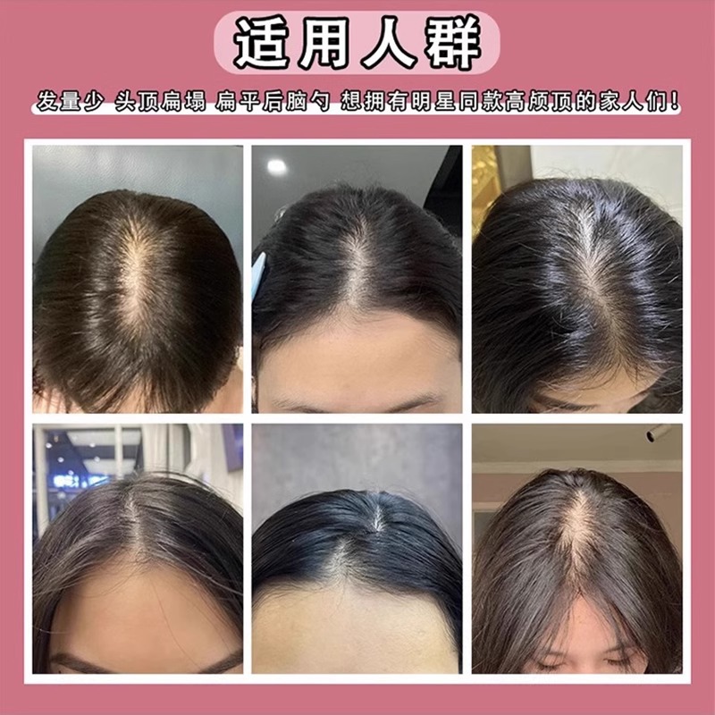 Peruca de cabello floppy artefacto de cabello craneal alto enchufe de cabello top pein para aumentar la raíz del cabello disco invisible clip de cabello pein