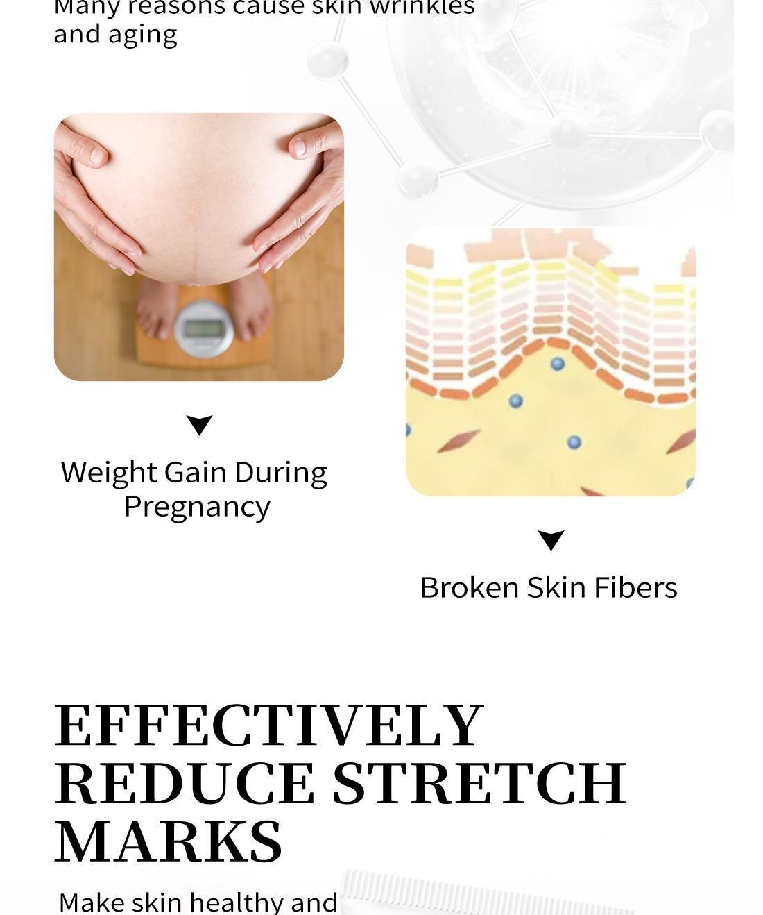 Crema reparadora de estrías para cuello COBEN_voghion.com