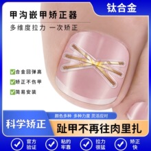 �ל�Ƕ��ָ������䓽z�����⁺Ͻ�����N�����NƬ�_ֺ���׳C����