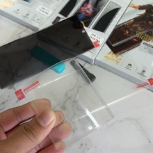 mxiaomi CIVI2UV䓻ĤĥɰĤСPOCOX7QȫĤ