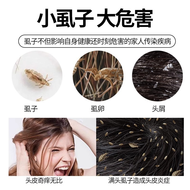 篦子梳去头屑除头虱加密儿童虱子梳去超密虱卵梳子老式梳头密齿梳|undefined