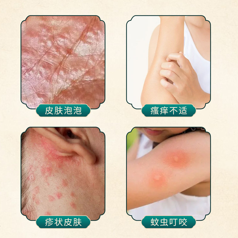 印度断痒膏本草萃取全身止痒膏抑菌膏皮肤瘙痒印度断痒膏工厂批发|undefined