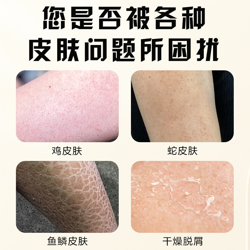 毛周角化面部小疙瘩脂肪粒舒缓女性少年面部组织重组肌肤鸡皮|undefined