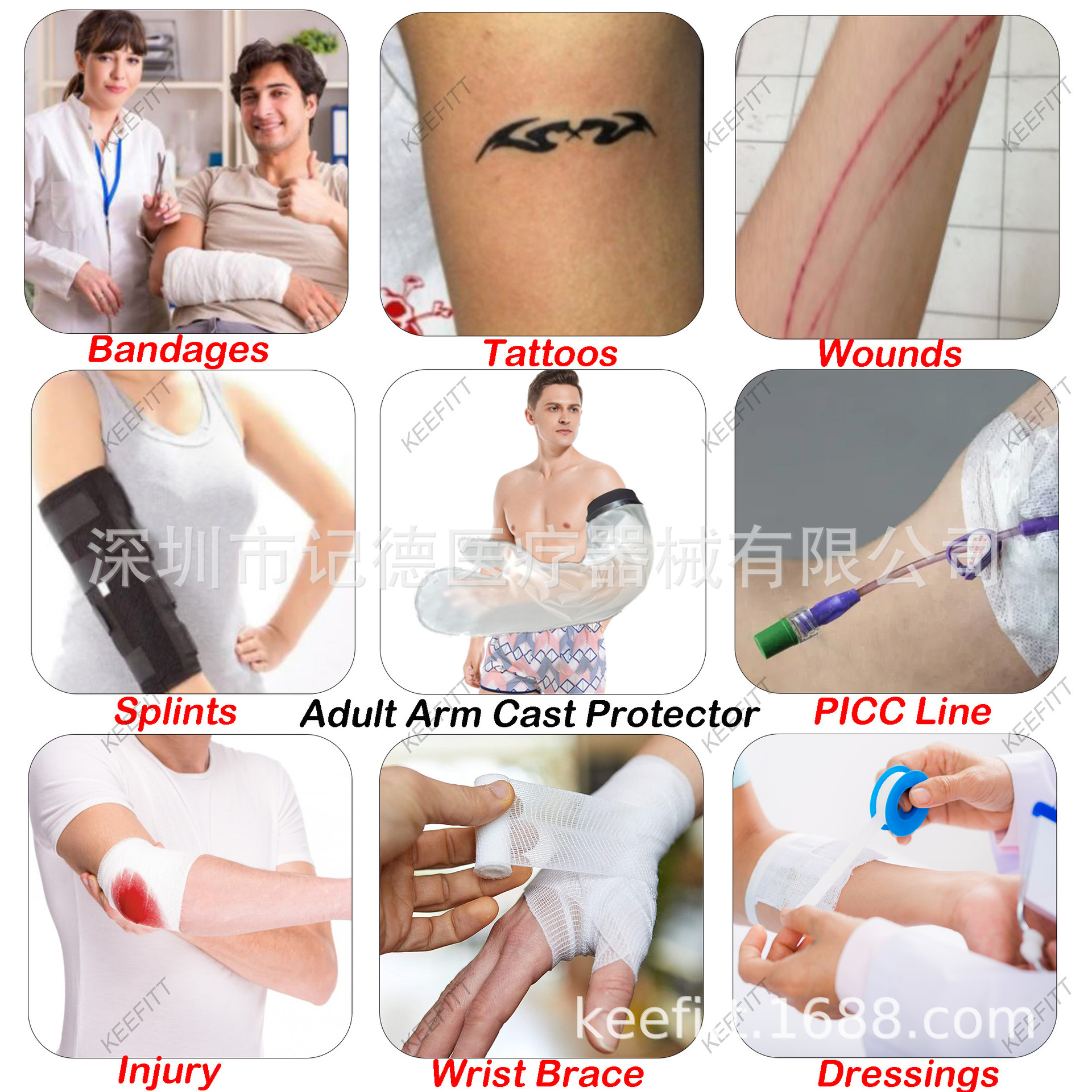 ARM cast protector