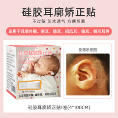 耳朵矯正 嬰幼兒耳廓外翻矯正貼招風耳貼面耳定型耳撐耳朵畸塑形