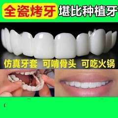 z牙套通用可用10年万能牙套仿真假牙吃饭神器美白缺牙蛀牙男女通