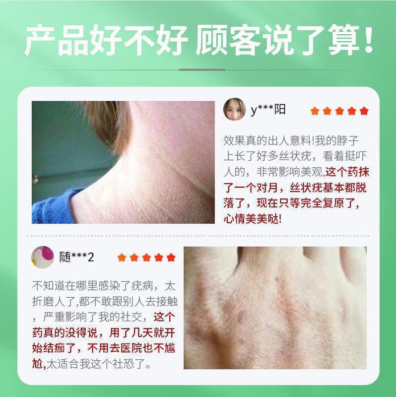 同仁堂のいぼの清寧の冷布はいぼの膏のゲルの男性女性の糸状のいぼの皮の冷布のゲルの源の卸売りを取り除きます。|undefined