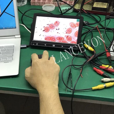 9inch Ultra-Thin Medical Microscope Car display