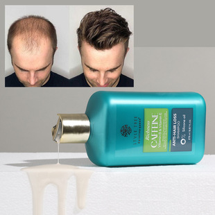 caffeine shampoo�������Óϴ�lˮOEM �o�������lϴ�l�����Q���l