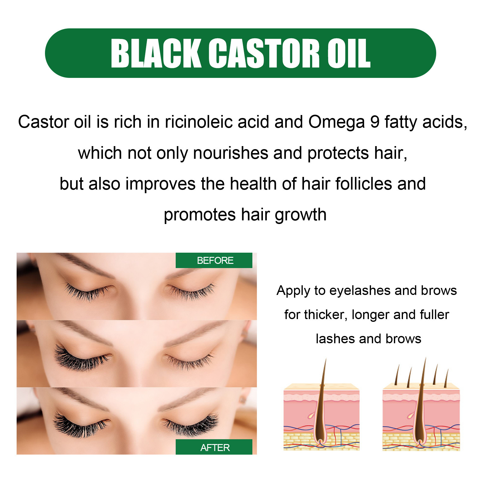 oil OUHOE castor conditioner improves hairline toughness, nourishes roots, softens hair, and prevents hair los_voghion.com