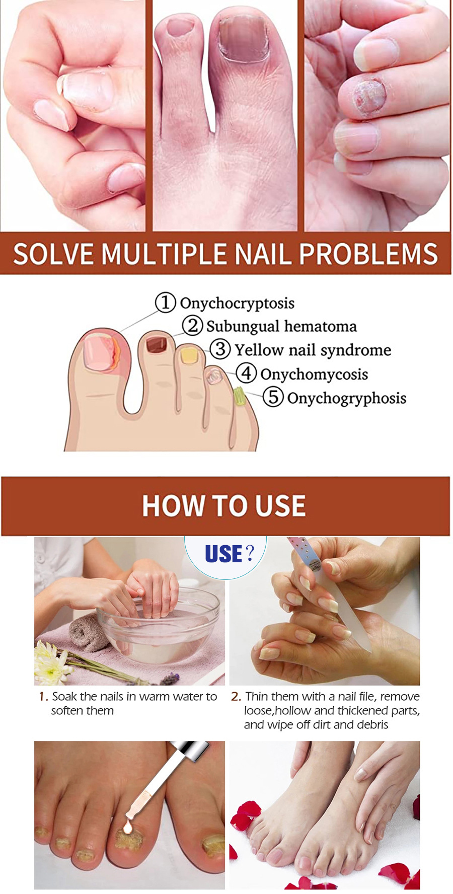 Crema desmaquillante antibacteriana especial para uñas, espesante para uñas suaves, y solución especial para uñas grises s,s_voghion.com